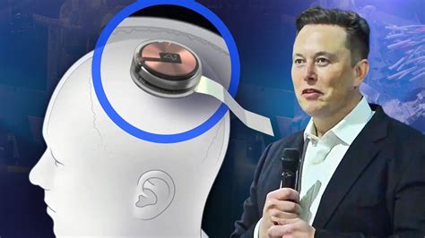 mind control rfid chip|Elon Musk's Neuralink Has Implanted Its First Chip in .